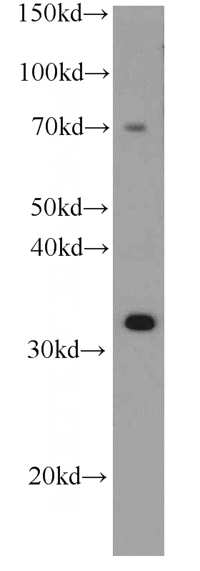human brain tissue were subjected to SDS PAGE followed by western blot with Catalog No:107613(SULT4A1 antibody) at dilution of 1:1000