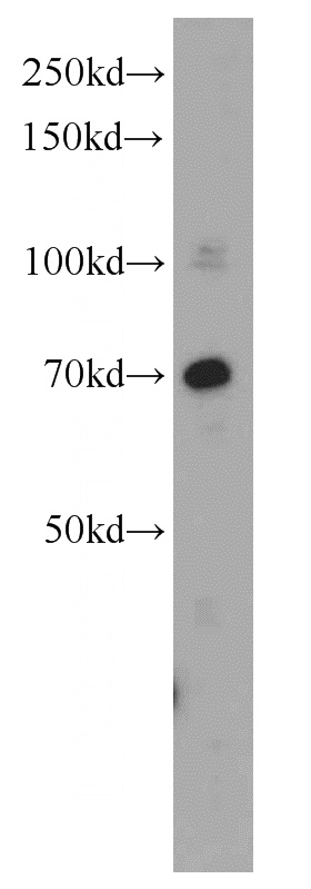 HepG2 cells were subjected to SDS PAGE followed by western blot with Catalog No:112653(MEN1 antibody) at dilution of 1:500
