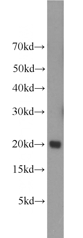 human spleen tissue were subjected to SDS PAGE followed by western blot with Catalog No:116539(UBE2V1 antibody) at dilution of 1:300