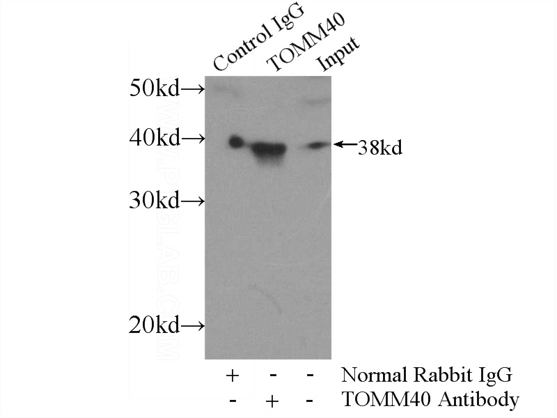IP Result of anti-TOMM40 (IP:Catalog No:116173, 4ug; Detection:Catalog No:116173 1:1000) with mouse liver tissue lysate 4000ug.