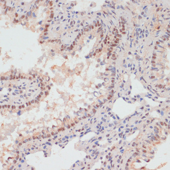 Immunohistochemistry - Phospho-PEA15-S104 pAb 
