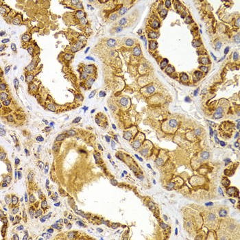 Immunohistochemistry - BMP15 Polyclonal Antibody 
