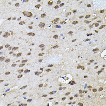 Immunohistochemistry - RNF166 Polyclonal Antibody 