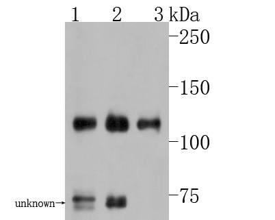 Fig1:; Western blot analysis of TAG1 on different lysates. Proteins were transferred to a PVDF membrane and blocked with 5% BSA in PBS for 1 hour at room temperature. The primary antibody ( 1/500) was used in 5% BSA at room temperature for 2 hours. Goat Anti-Rabbit IgG - HRP Secondary Antibody (HA1001) at 1:5,000 dilution was used for 1 hour at room temperature.; Positive control:; Lane 1: Mouse cerebellum tissue lysate; Lane 2: Human brain tissue lysate; Lane 3: Rat cerebellum tissue lysate