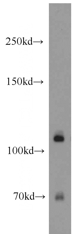 mouse brain tissue were subjected to SDS PAGE followed by western blot with Catalog No:113181(NCSTN antibody) at dilution of 1:800