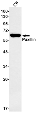 Western blot detection of Paxillin in C6 cell lysates using Paxillin Rabbit mAb(1:1000 diluted).Predicted band size:65kDa.Observed band size:65kDa.