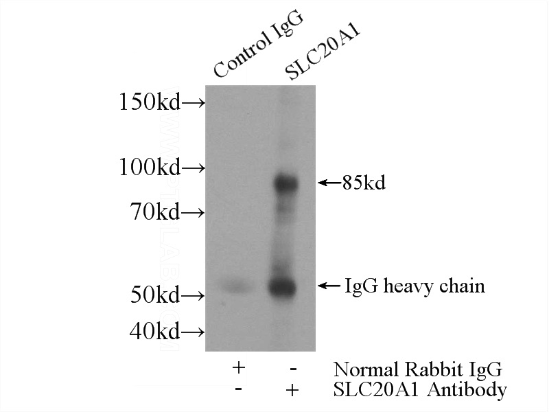 IP Result of anti-SLC20A1 (IP:Catalog No:115310, 4ug; Detection:Catalog No:115310 1:500) with HEK-293 cells lysate 2800ug.