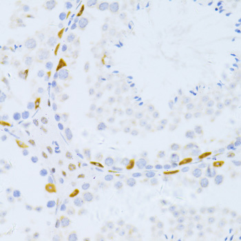 Immunohistochemistry - ZEB2 Polyclonal Antibody 