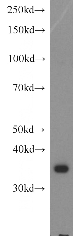 HeLa cells were subjected to SDS PAGE followed by western blot with Catalog No:113889(TP53I3 antibody) at dilution of 1:1000