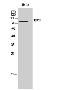 Fig1:; Western Blot analysis of HeLa cells using TMC8 Polyclonal Antibody. Secondary antibody（catalog#: HA1001) was diluted at 1:20000