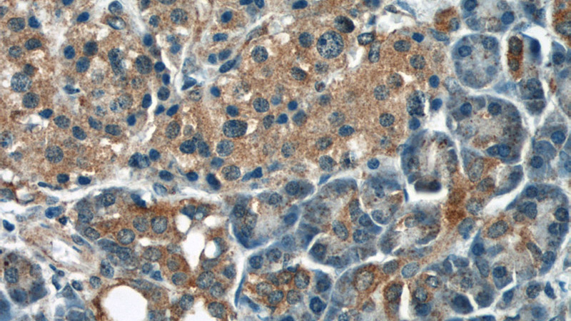 Immunohistochemical of paraffin-embedded human pancreas using Catalog No:110142(DYNLT1 antibody) at dilution of 1:50 (under 40x lens)
