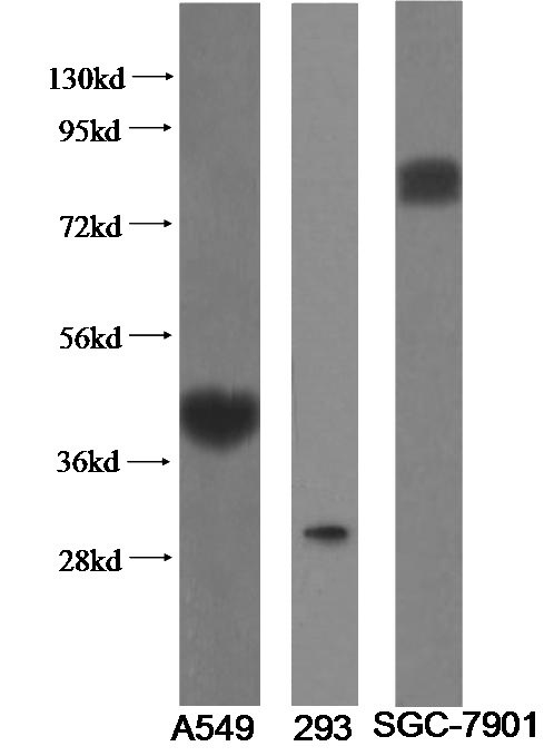 Variants of IL1RL1 recognized by Catalog No:115621.