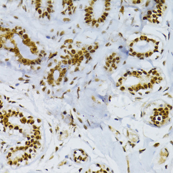 Immunohistochemistry - SNRNP70 Polyclonal Antibody 