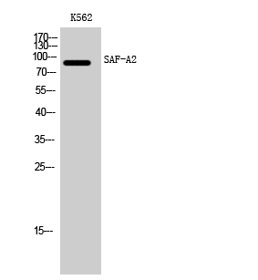 Fig1:; Western Blot analysis of K562 cells using SAF-A2 Polyclonal Antibody cells nucleus extracted by Minute TM Cytoplasmic and Nuclear Fractionation kit (SC-003,Inventbiotech,MN,USA).