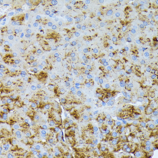 Immunohistochemistry - CTRB1 Polyclonal Antibody 