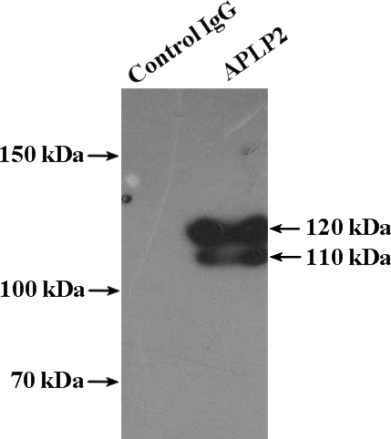 IP Result of anti-APLP2 (IP:Catalog No:108021, 4ug; Detection:Catalog No:108021 1:300) with mouse brain tissue lysate 4000ug.