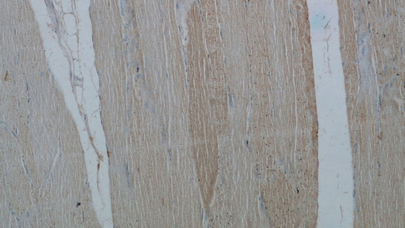 Immunohistochemical of paraffin-embedded human skeletal muscle using Catalog No:116316(TRIM41 antibody) at dilution of 1:50 (under 10x lens)