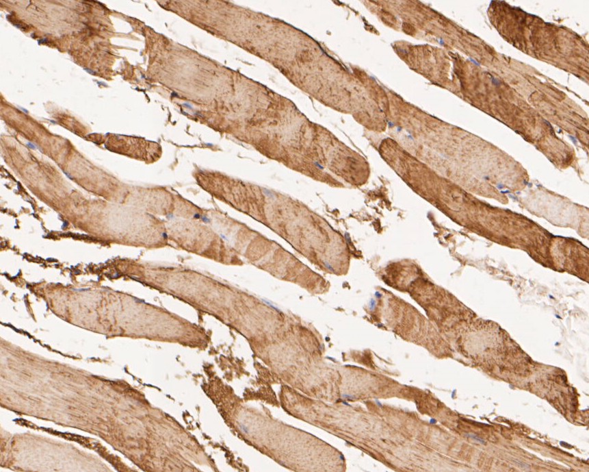 Fig5: Immunohistochemical analysis of paraffin-embedded mouse skeletal muscle tissue using anti-KCNK18 antibody. The section was pre-treated using heat mediated antigen retrieval with Tris-EDTA buffer (pH 8.0-8.4) for 20 minutes.The tissues were blocked in 5% BSA for 30 minutes at room temperature, washed with ddH2O and PBS, and then probed with the primary antibody ( 1/50) for 30 minutes at room temperature. The detection was performed using an HRP conjugated compact polymer system. DAB was used as the chromogen. Tissues were counterstained with hematoxylin and mounted with DPX.