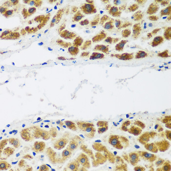 Immunohistochemistry - NAA60 Polyclonal Antibody 
