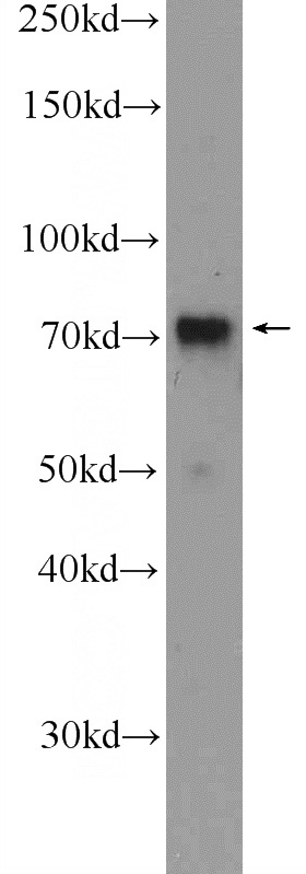 K-562 cells were subjected to SDS PAGE followed by western blot with Catalog No:114507(RACGAP1 Antibody) at dilution of 1:600