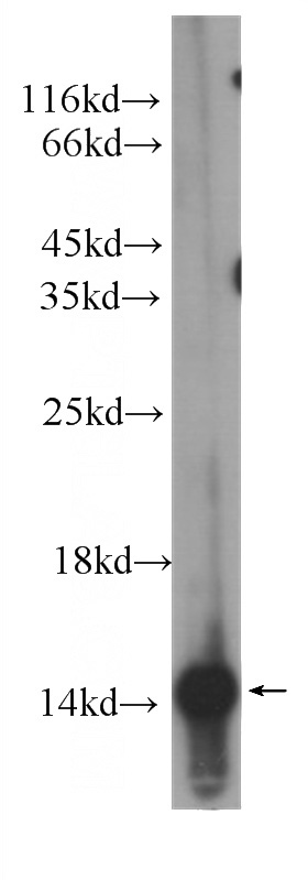 human skeletal muscle tissue were subjected to SDS PAGE followed by western blot with Catalog No:107197(FABP3 Antibody) at dilution of 1:2000