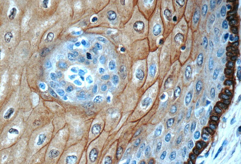 Immunohistochemistry of paraffin-embedded human oesophagus tissue slide using Catalog No:108089(ANXA1 Antibody) at dilution of 1:50 (under 40x lens)
