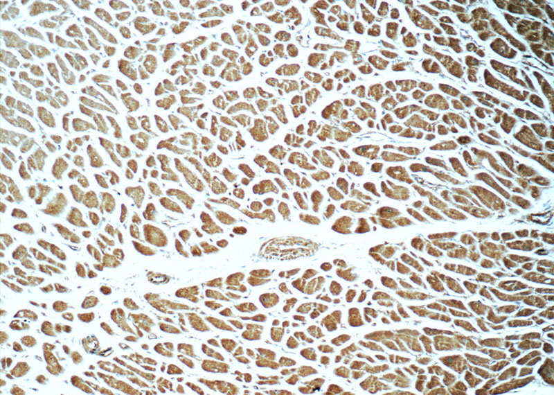 Immunohistochemistry of paraffin-embedded human heart tissue slide using Catalog No:115242(SIRT2 Antibody) at dilution of 1:50 (under 10x lens)