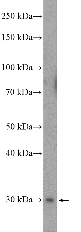mouse brain tissue were subjected to SDS PAGE followed by western blot with Catalog No:108106(SLC25A5 Antibody) at dilution of 1:300