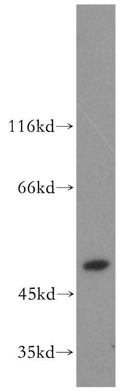 human placenta tissue were subjected to SDS PAGE followed by western blot with Catalog No:114141(PPOX antibody) at dilution of 1:500
