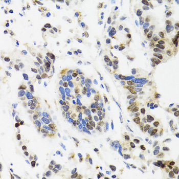 Immunohistochemistry - TOP1 Polyclonal Antibody 