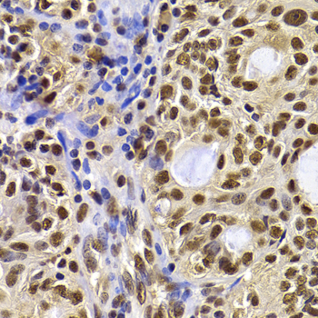 Immunohistochemistry - HIRIP3 Polyclonal Antibody 