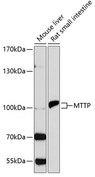Western blot - MTTP Polyclonal Antibody 