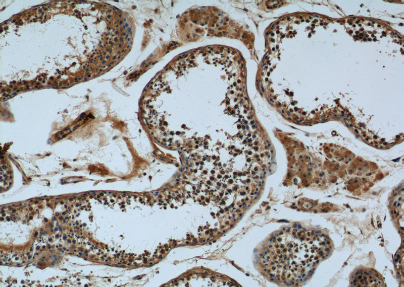 Immunohistochemistry of paraffin-embedded human testis tissue slide using Catalog No:112022(KDELC2 Antibody) at dilution of 1:50 (under 10x lens)