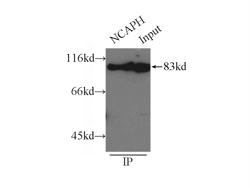 IP Result of anti-NCAPH (IP:Catalog No:113032, 3ug; Detection:Catalog No:113032 1:800) with HeLa cells lysate 3000ug.