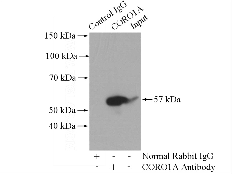 IP Result of anti-CORO1A (IP:Catalog No:109474, 4ug; Detection:Catalog No:109474 1:1000) with mouse spleen tissue lysate 4800ug.
