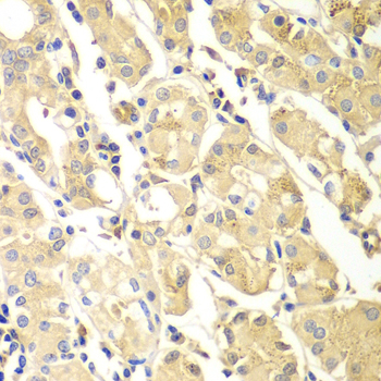 Immunohistochemistry - PDCD2L Polyclonal Antibody 