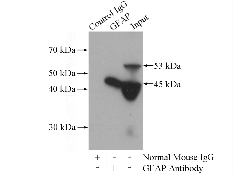 IP Result of anti-GFAP (IP:Catalog No:107295, 5ug; Detection:Catalog No:107295 1:1000) with mouse brain tissue lysate 2640ug.
