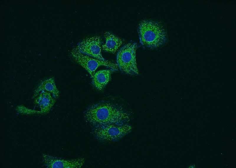 Immunofluorescent analysis of SH-SY5Y cells using Catalog No:115336(SLC25A45 Antibody) at dilution of 1:50 and Alexa Fluor 488-congugated AffiniPure Goat Anti-Rabbit IgG(H+L)