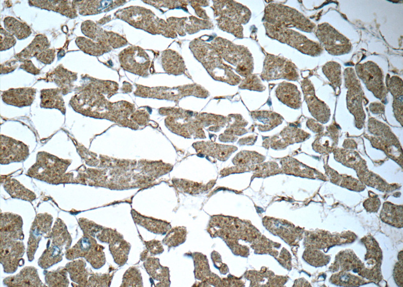 Immunohistochemistry of paraffin-embedded human heart tissue slide using Catalog No:115243(SIRT2 Antibody) at dilution of 1:50