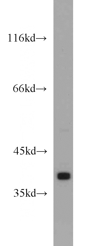 human testis tissue were subjected to SDS PAGE followed by western blot with Catalog No:113844(PRKACA antibody) at dilution of 1:500