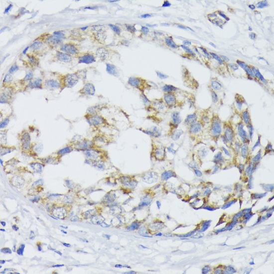 Immunohistochemistry - SLC30A1 Polyclonal Antibody 