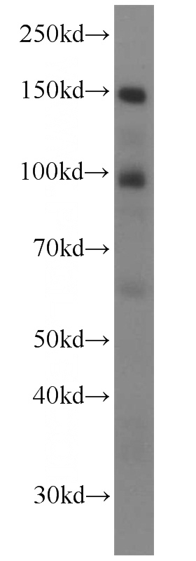 HeLa cells were subjected to SDS PAGE followed by western blot with Catalog No:113503(PALLD,palladin antibody) at dilution of 1:2000