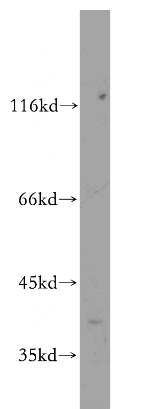mouse liver tissue were subjected to SDS PAGE followed by western blot with Catalog No:110698(FOXH1-Specific antibody) at dilution of 1:300