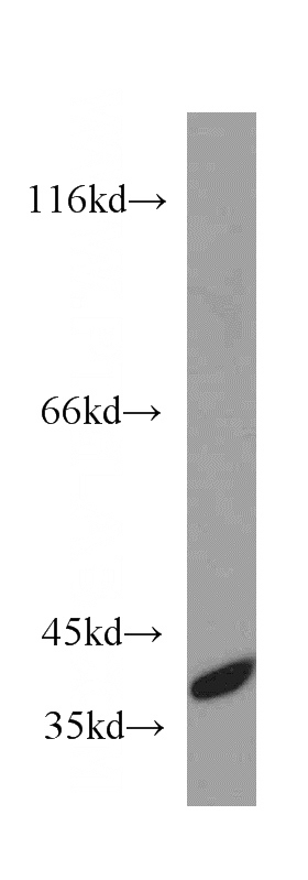 K-562 cells were subjected to SDS PAGE followed by western blot with Catalog No:108977(CCDC50 antibody) at dilution of 1:500