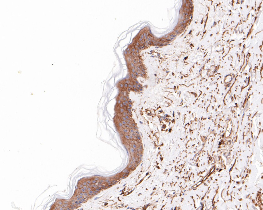 Fig10:; Immunohistochemical analysis of paraffin-embedded human skin tissue using anti-Vitronectin antibody. The section was pre-treated using heat mediated antigen retrieval with Tris-EDTA buffer (pH 8.0-8.4) for 20 minutes.The tissues were blocked in 5% BSA for 30 minutes at room temperature, washed with ddH; 2; O and PBS, and then probed with the primary antibody ( 1/200) for 30 minutes at room temperature. The detection was performed using an HRP conjugated compact polymer system. DAB was used as the chromogen. Tissues were counterstained with hematoxylin and mounted with DPX.