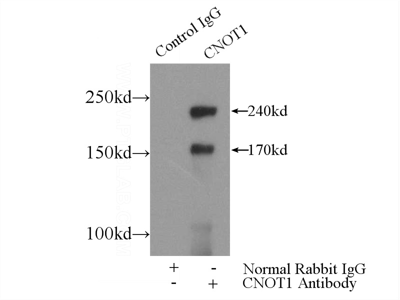 IP Result of anti-CNOT1 (IP:Catalog No:109431, 5ug; Detection:Catalog No:109431 1:500) with mouse kidney tissue lysate 4000ug.