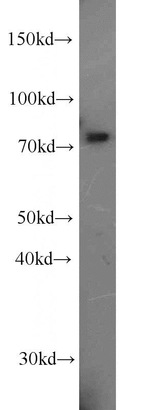 HeLa cells were subjected to SDS PAGE followed by western blot with Catalog No:107802(ABCD1 antibody) at dilution of 1:1000