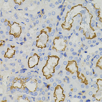 Immunohistochemistry - STX1A Polyclonal Antibody 