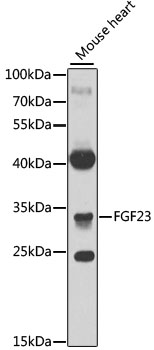 Western blot - FGF23 Polyclonal Antibody 