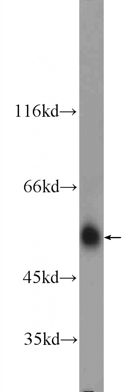 mouse brain tissue were subjected to SDS PAGE followed by western blot with Catalog No:108150(ARMC5 Antibody) at dilution of 1:300